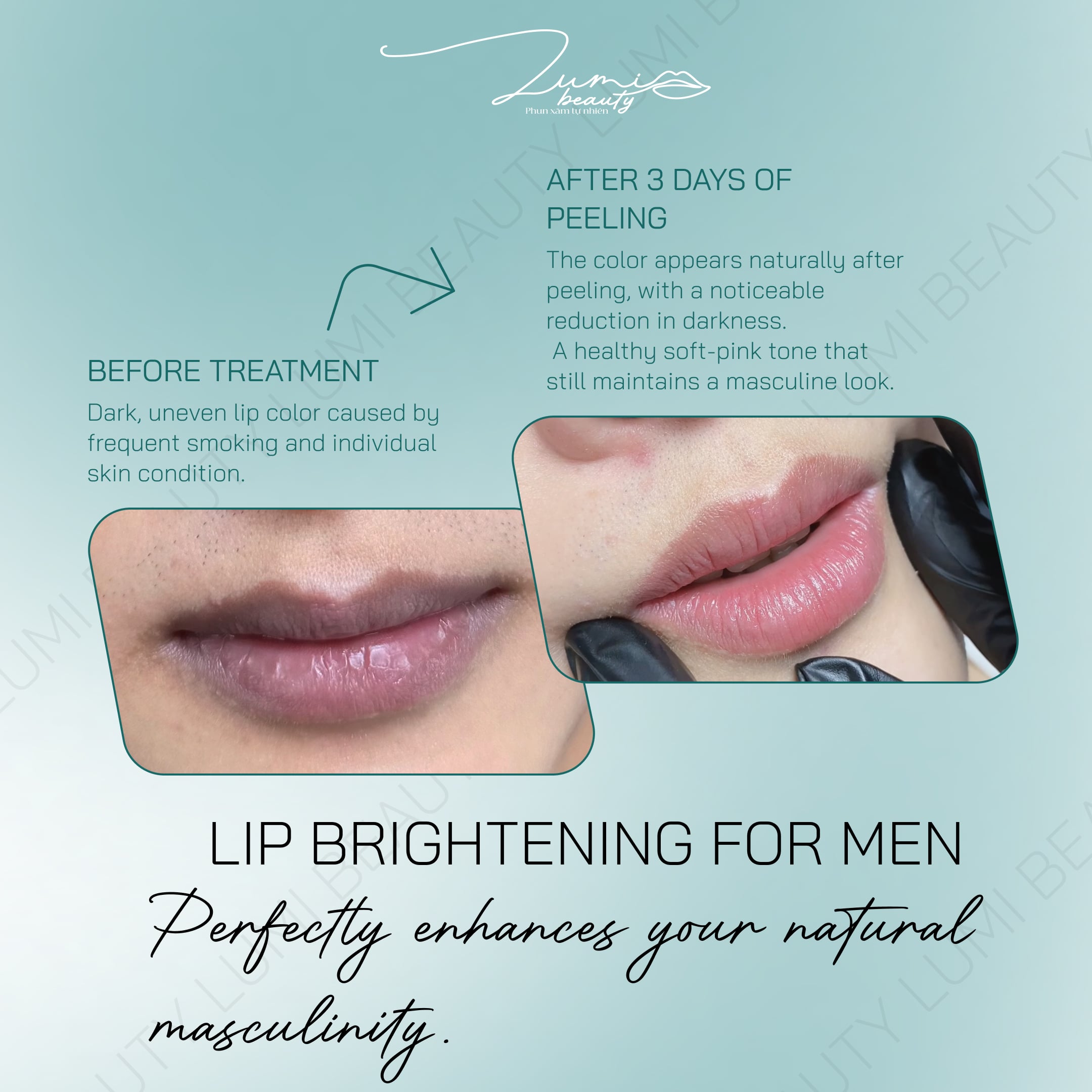 Lip darkening removal for men before and after