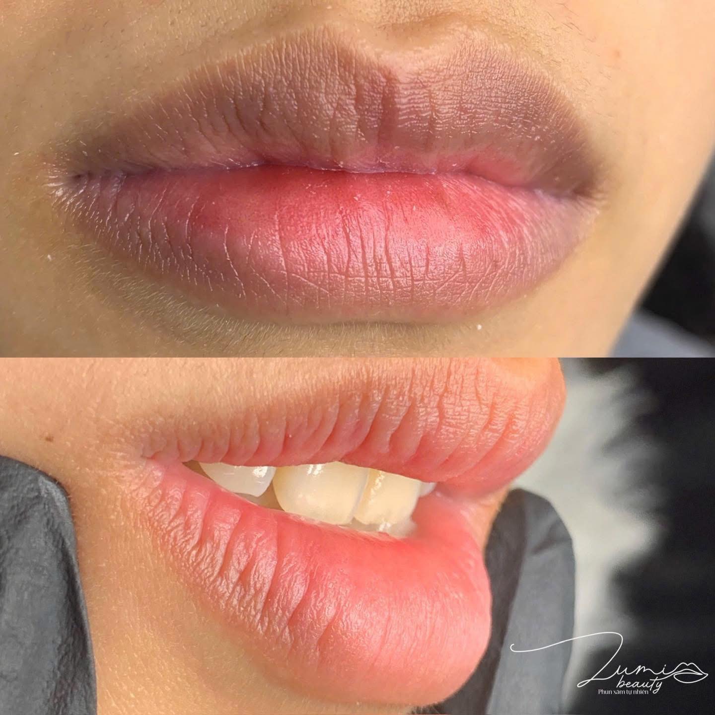 Lumi Beauty gallery 13