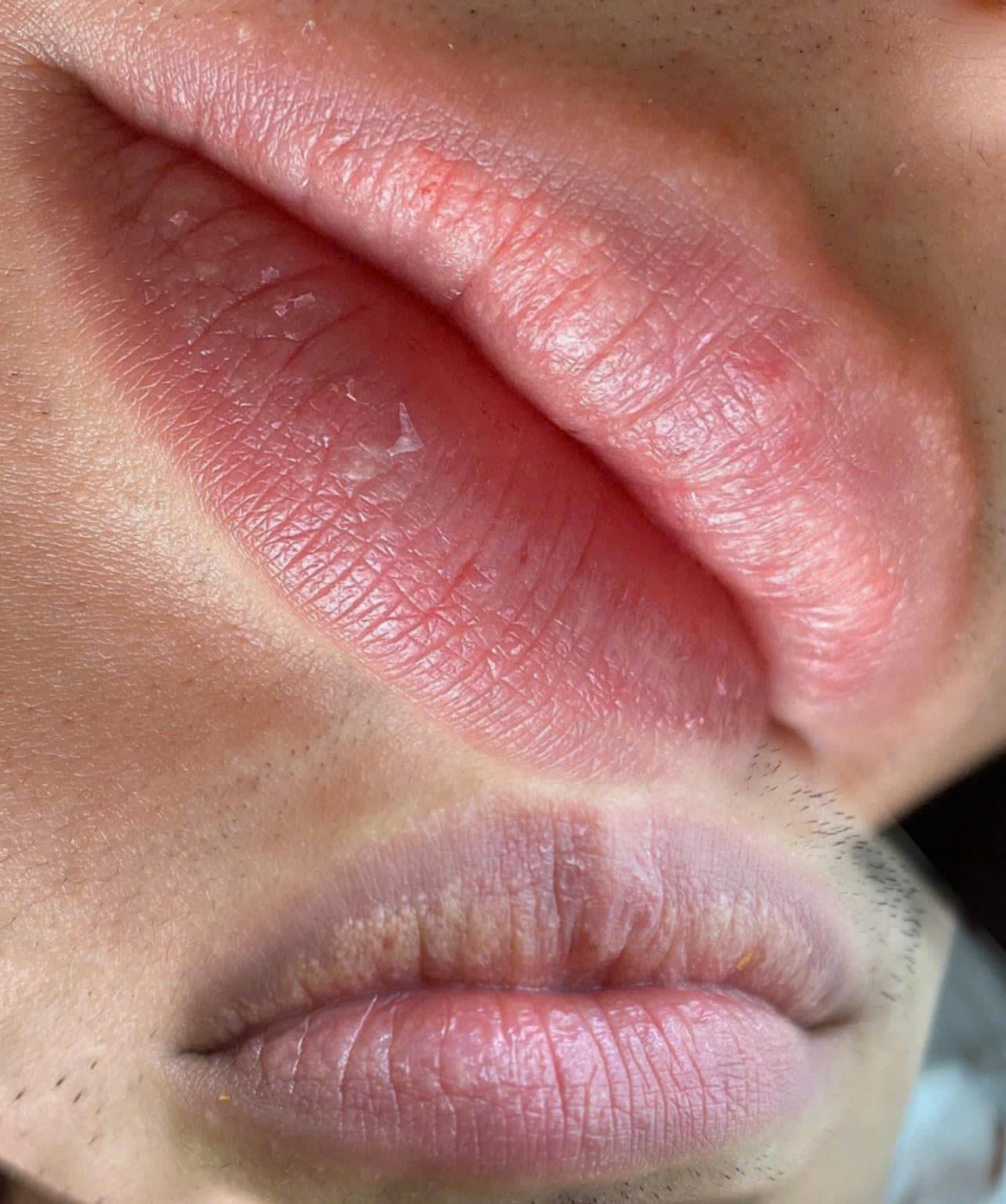 Khử thâm môi Lumi Beauty