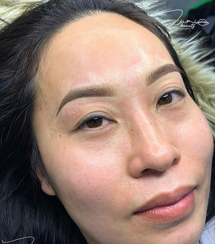 Mặt dài - Shading ngang tự nhiên