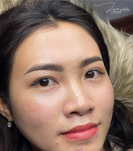 Mặt tròn - Shading có góc nhẹ