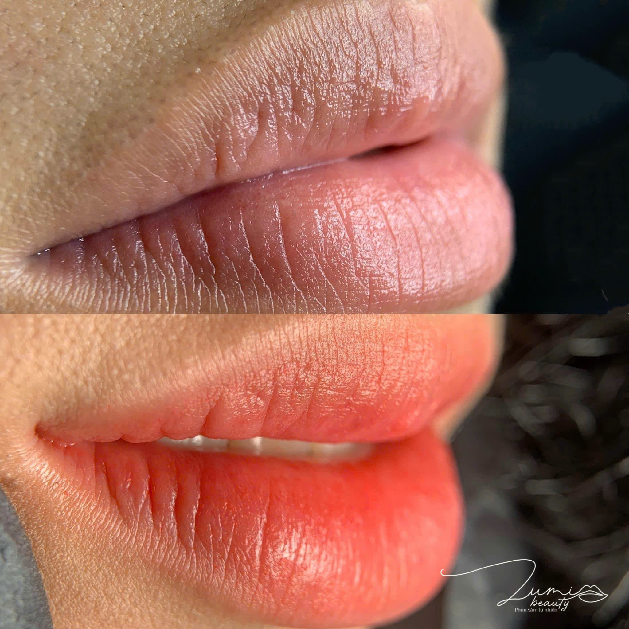 Môi bong không đều màu sau phun