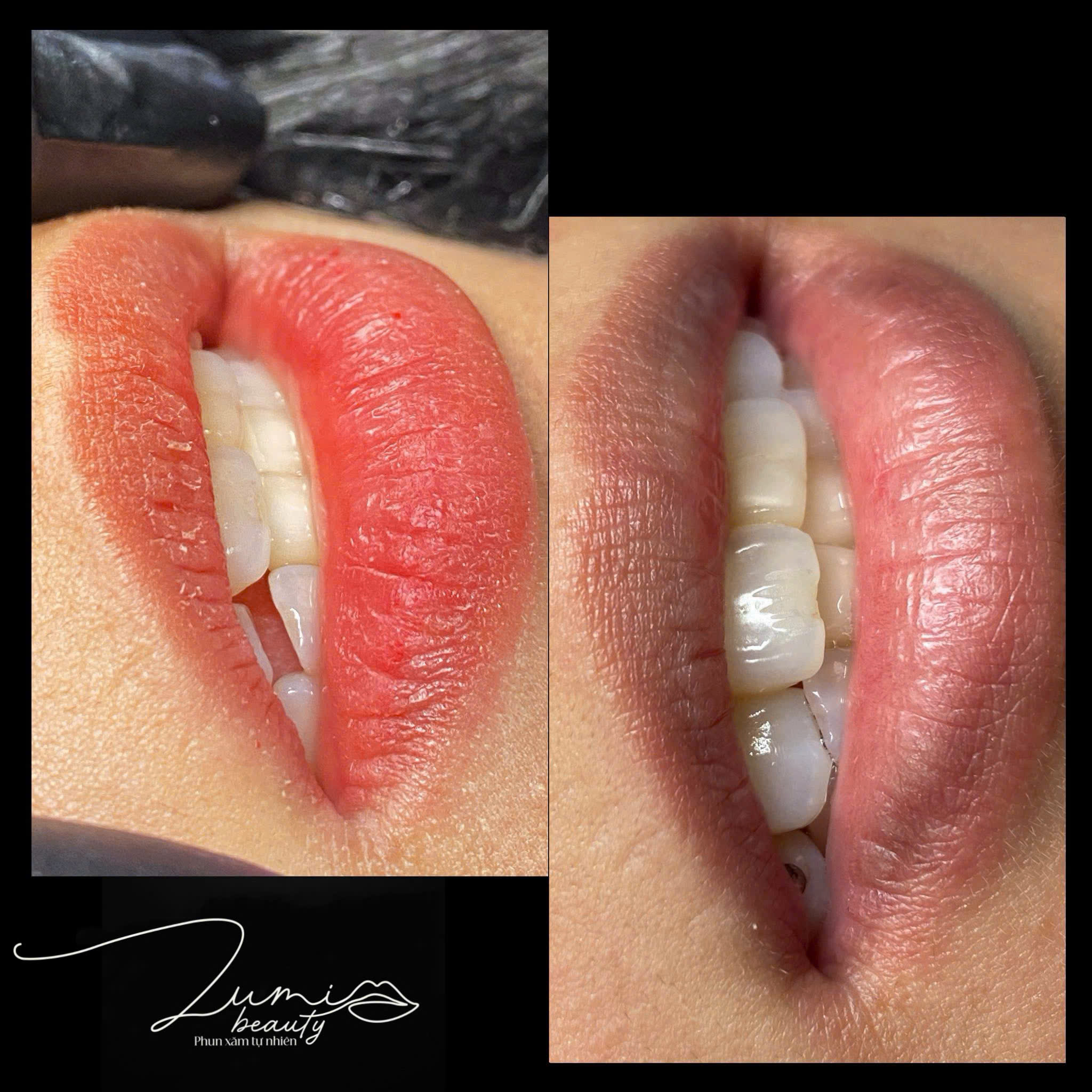 루미 뷰티에서 블러싱한 입술