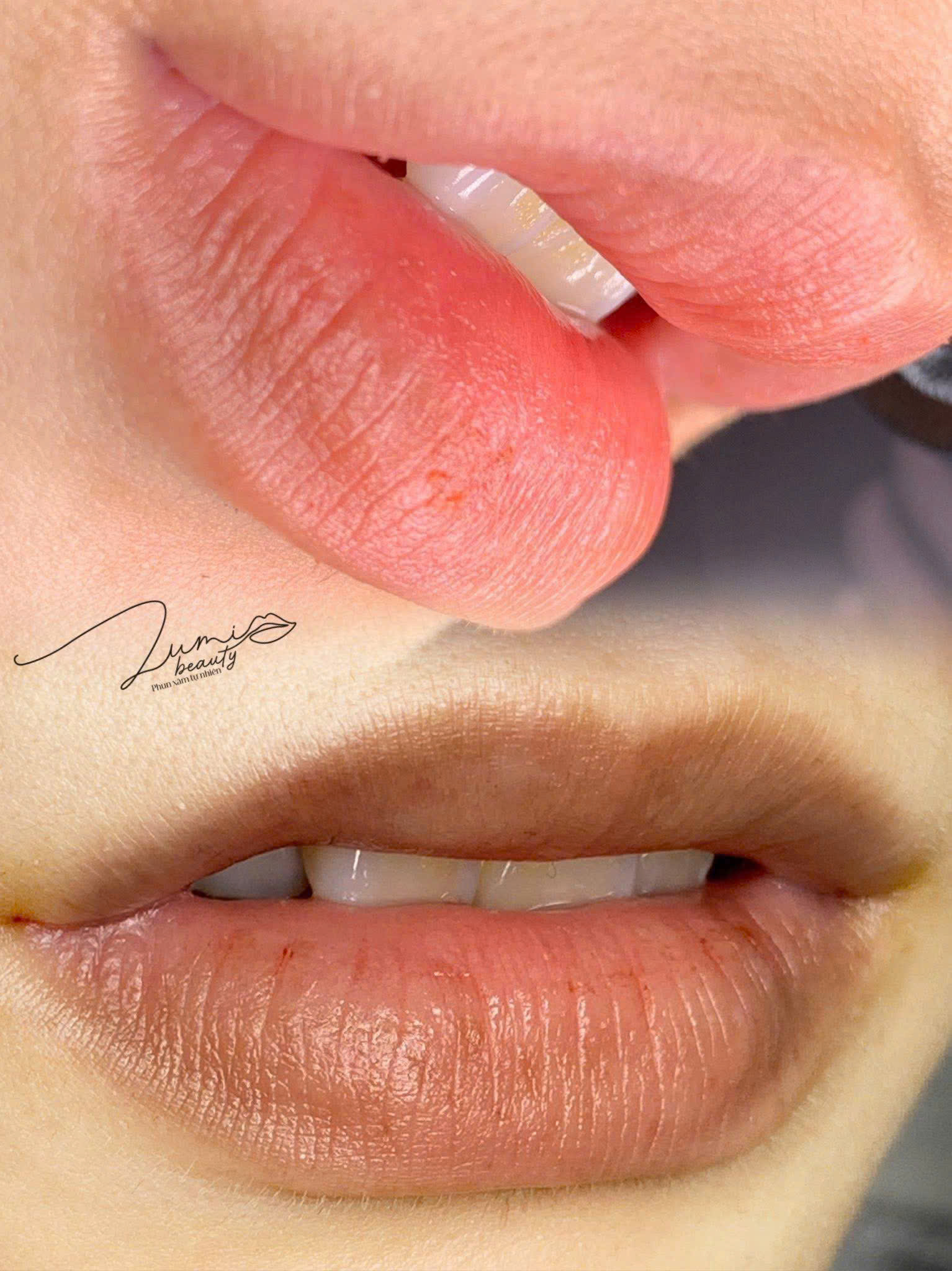 Kết quả phun môi trước và sau