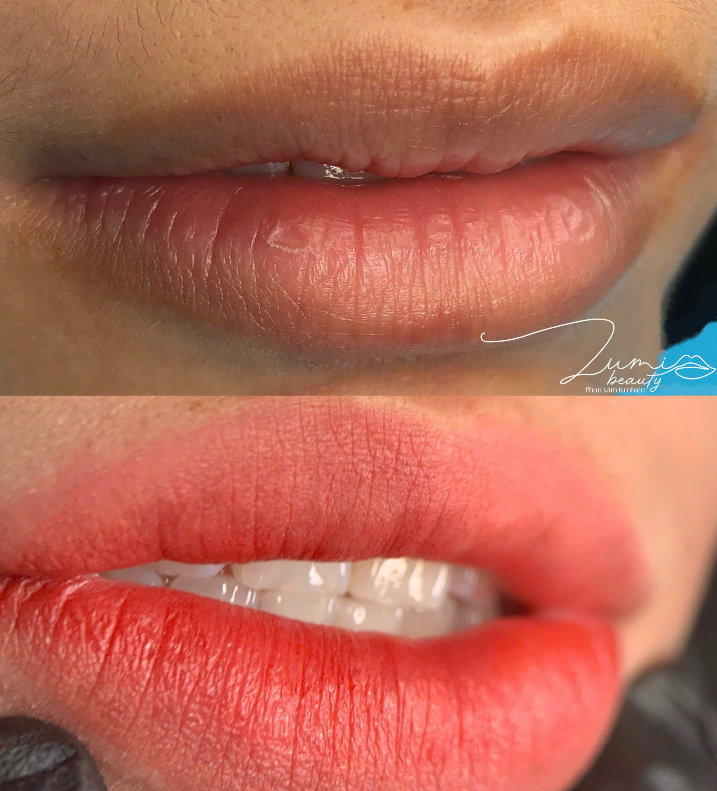 Kết quả phun môi trước và sau