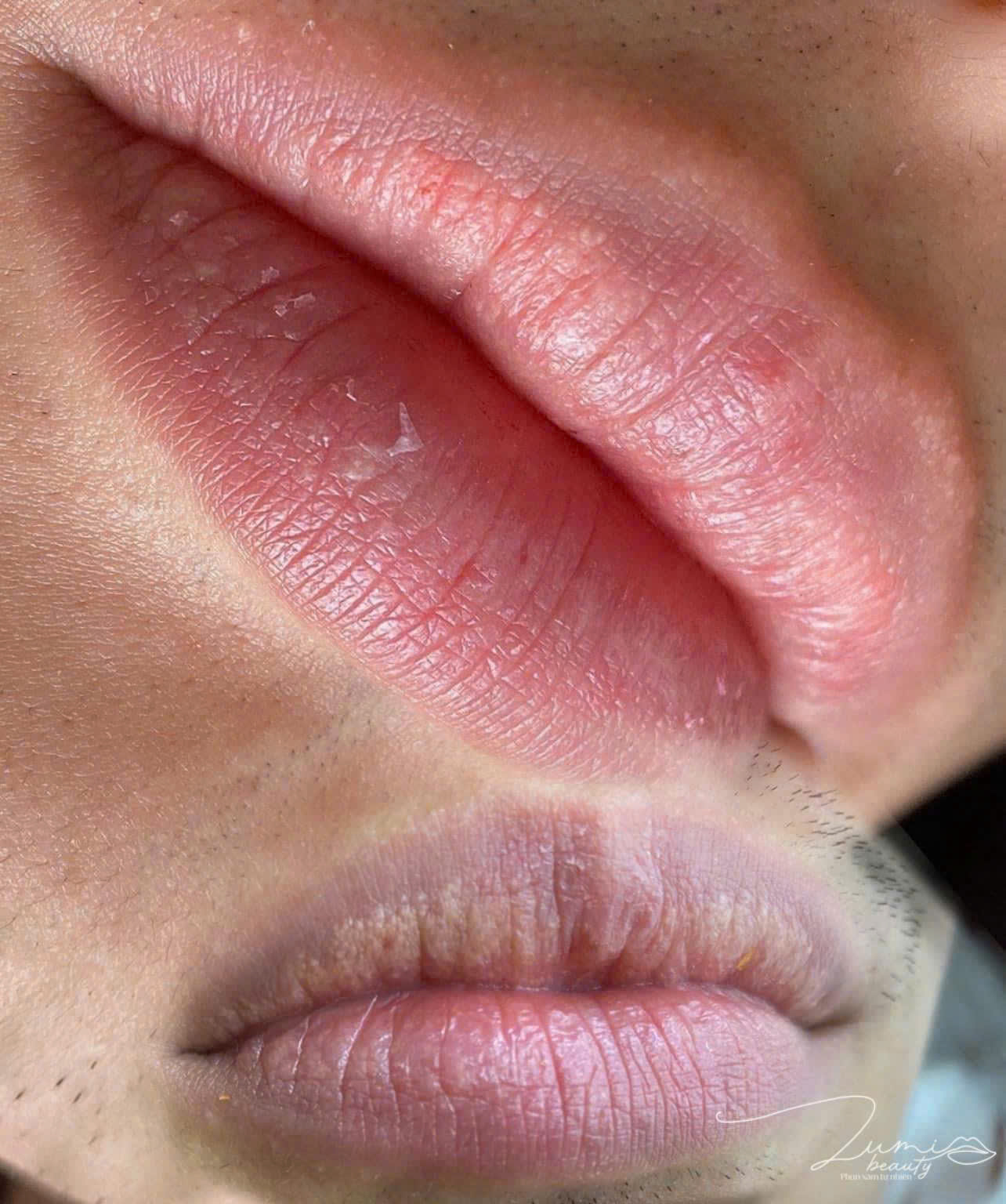 Kết quả phun môi trước và sau