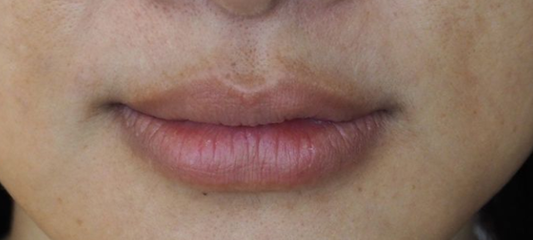 Màu môi không đều