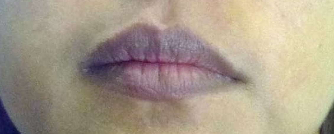 Môi thâm, xỉn màu